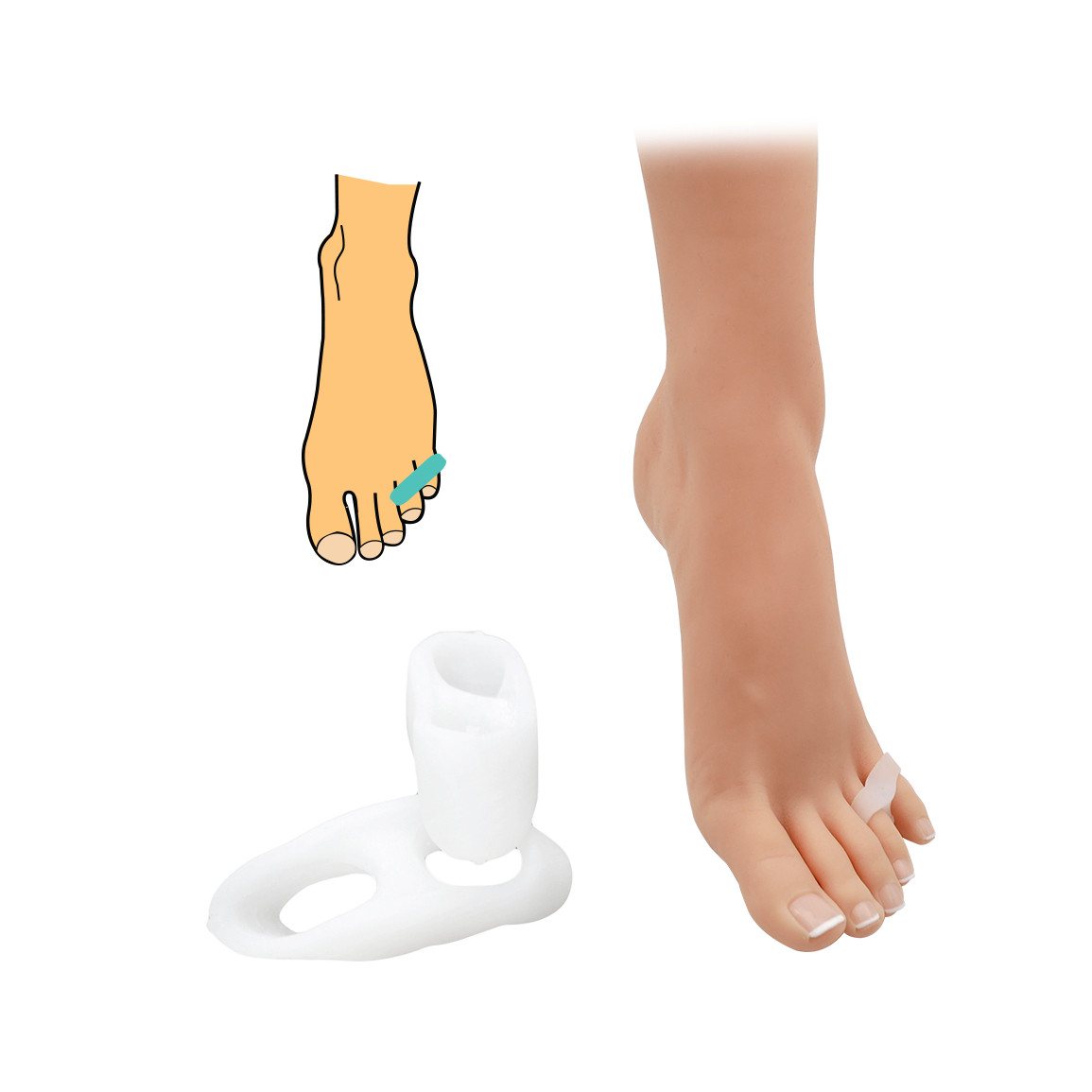 Korektor s návlekem na prst a malíček HealMed 1 pár - bílý