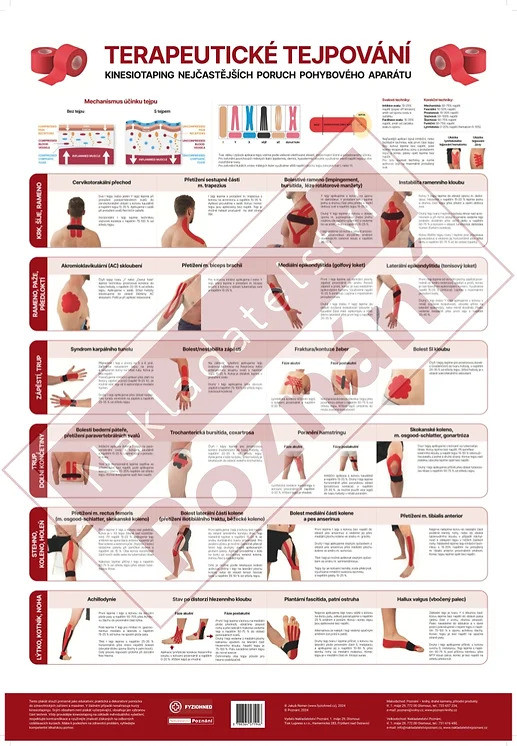 Vydavatelství Poznání Plakát - Terapeutické tejpování