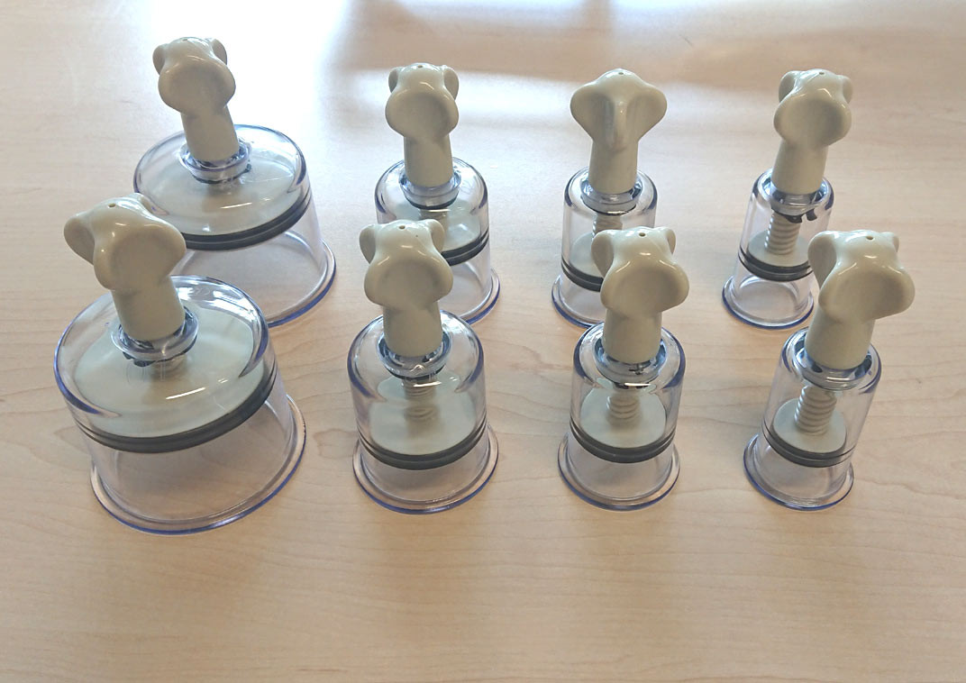 Shenzhen M Elegancy Tech Ltd. Sada 8 šroubovacích masážních baněk