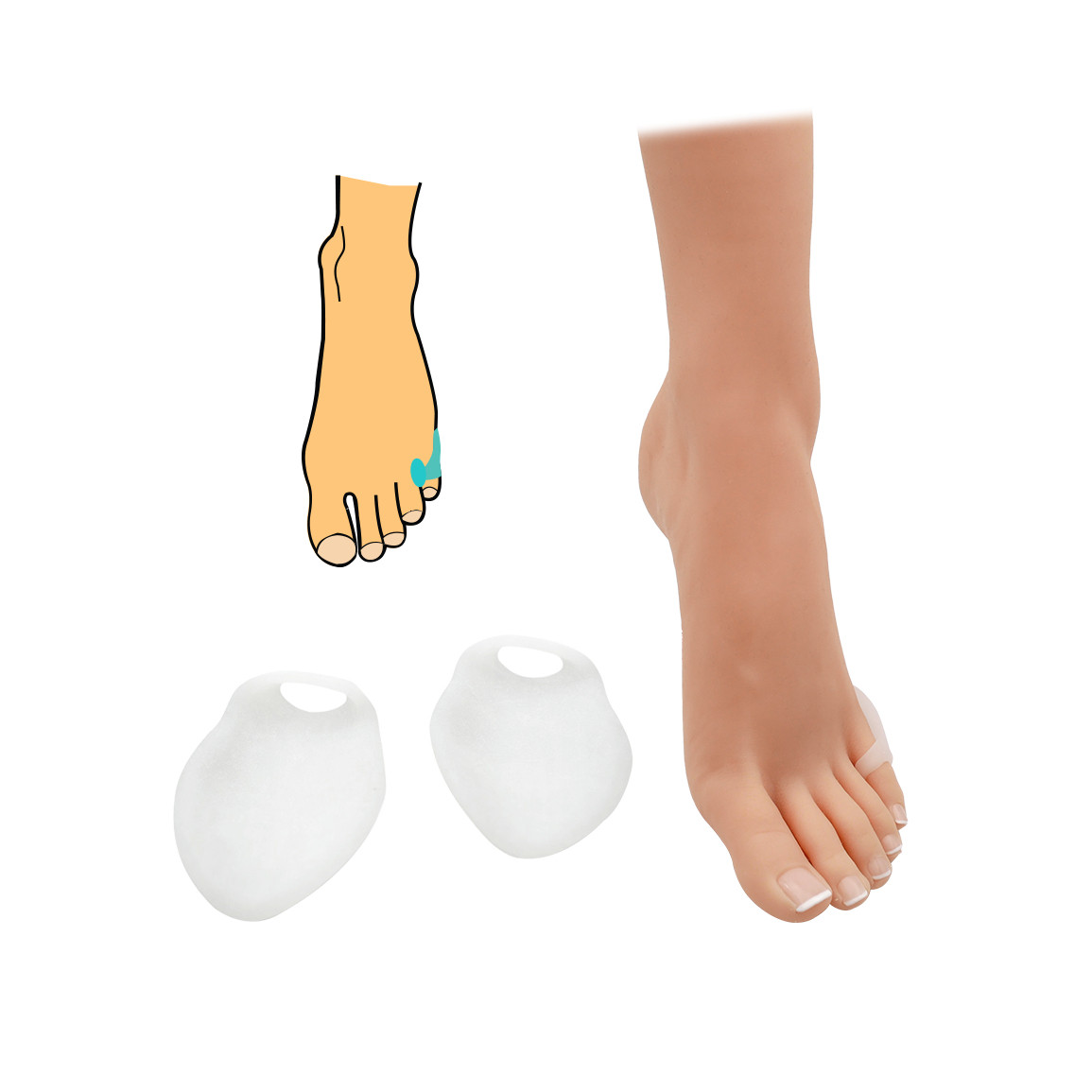 Chránič malíčku HealMed 1 pár - bílý