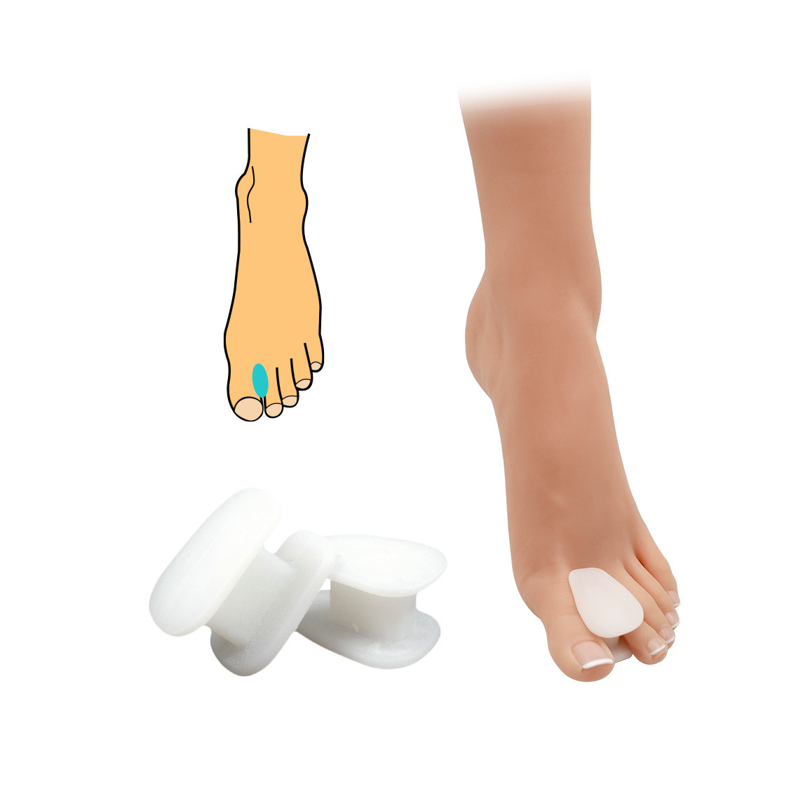 Korektor vybočeného palce HealthMed 2 ks - průhledný