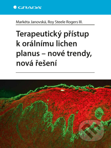 Terapeutický přístup k orálnímu lichen planus - nové trendy, nová řešení - Markéta Janovská, Roy Steele Rogers III.