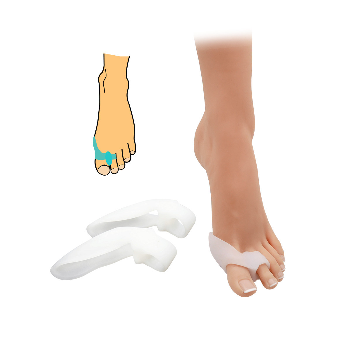 Korektor hallux valgus s návlekem na prsty HealMed 2 ks - průhledný