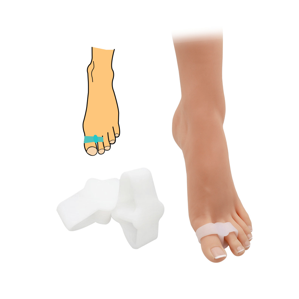 Korektor hallux valgus s návlekem na prst a palec HealMed 2 ks - průhledný