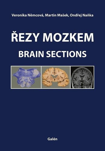 Řezy mozkem / Brain Sections - Veronika Němcová