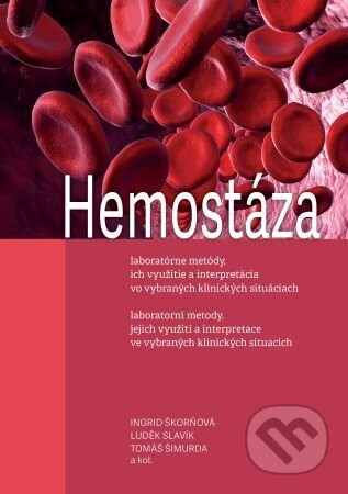 Hemostáza, laboratorní metody, jejich využití a interpretace ve vybraných klinických situacích - Ingrid Škorňová