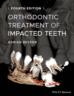 Orthodontic Treatment of Impacted Teeth -  (Becker Adrian)(Pevná vazba)