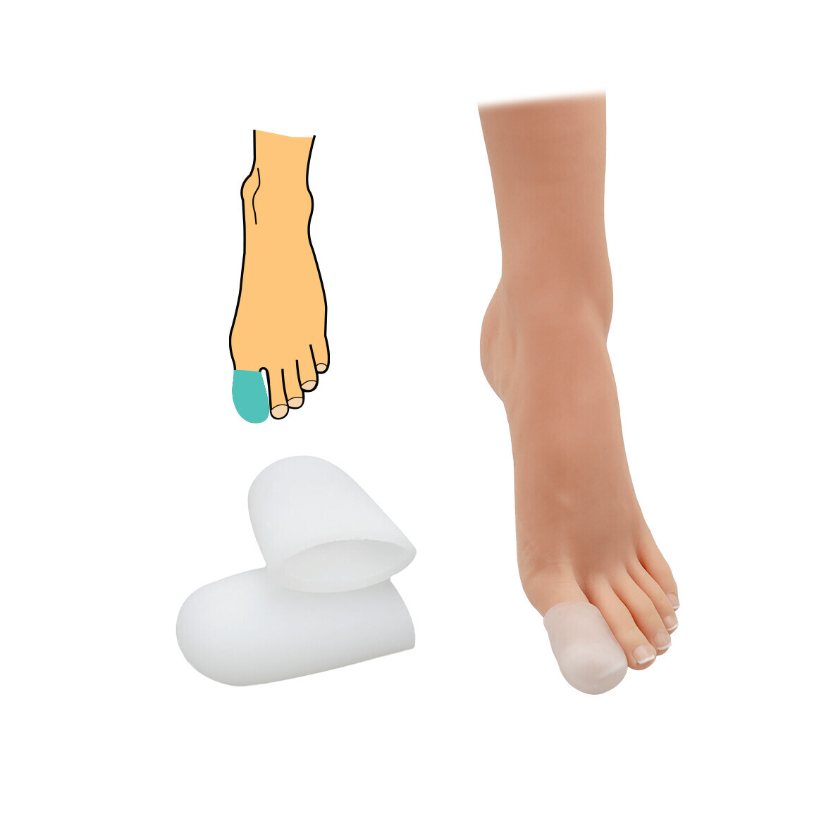 Chránič palce uzavřený HealMed 2 ks - průhledný