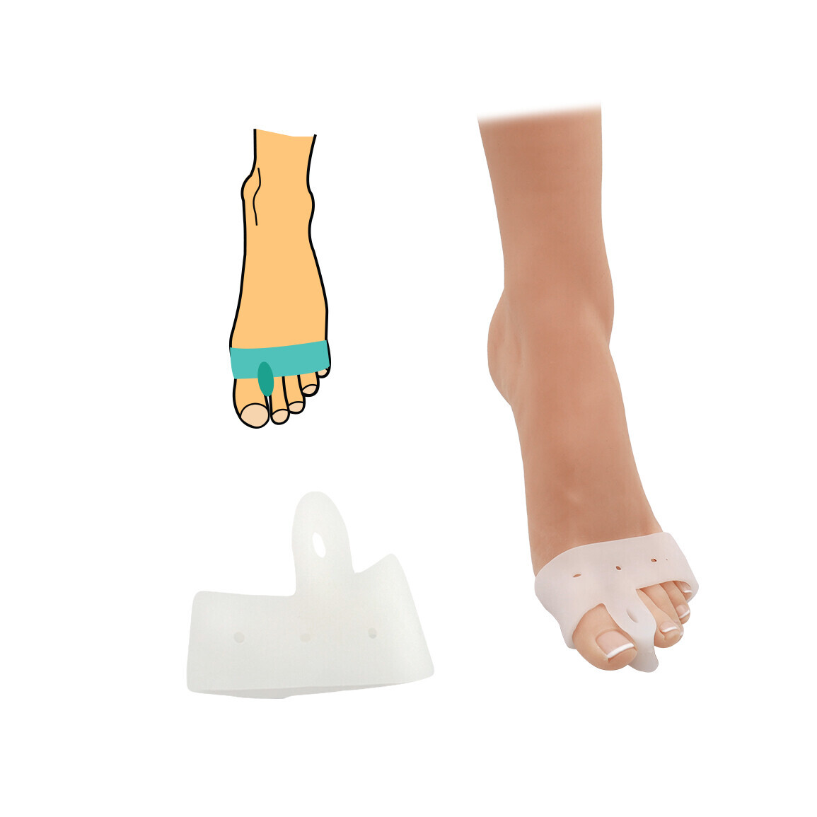 Chránič na hallux s meziprstním korektorem 1 pár - průhledný