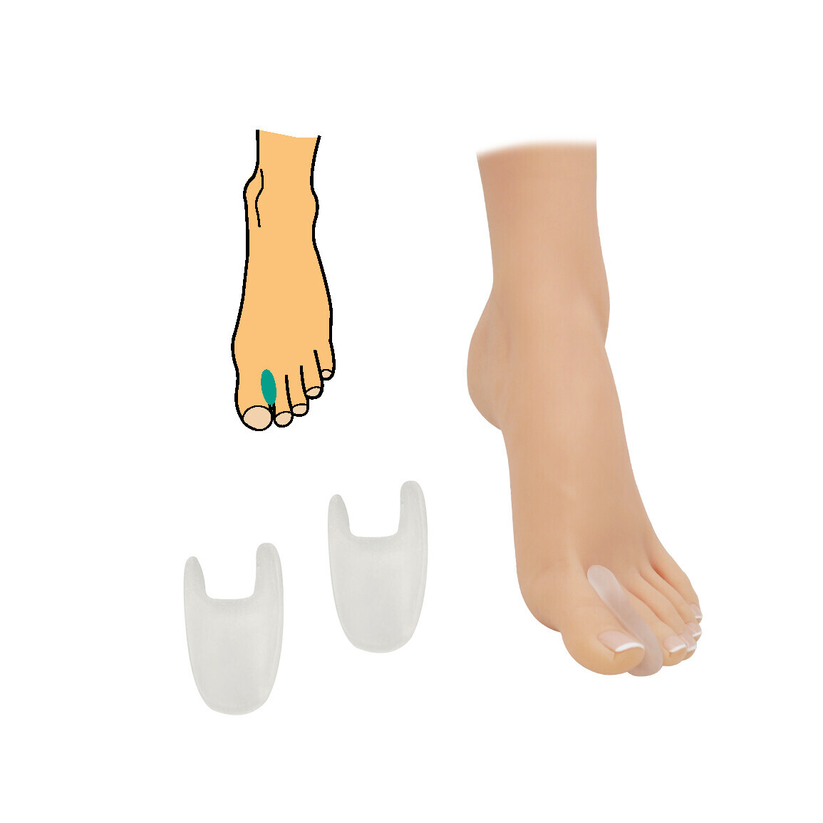 Korektor vybočeného palce úzký HealthMed 1 pár - průhledný, malá