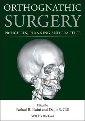 Orthognathic Surgery: Principles, Planning and Practice -  (Naini Farhad B.)(Pevná vazba)