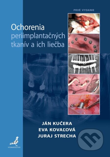 Ochorenia periimplantačných tkanív a ich liečba - Juraj Strecha, Eva Kovaľová, Ján Kučera