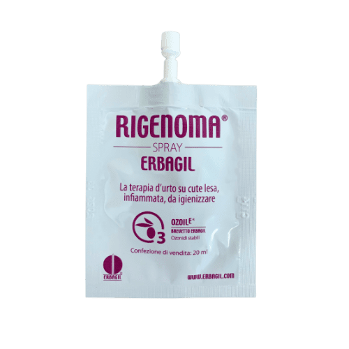 RIGENOMA – VZOREK bioaktivní sprej na rány s OZOILE 3 ml