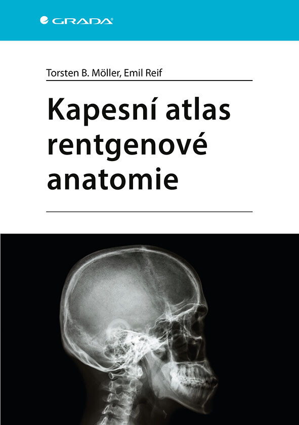 E-kniha: Kapesní atlas rentgenové anatomie od Möller Torsten B.