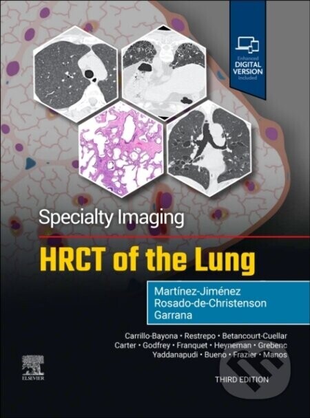 Specialty Imaging: HRCT of the Lung - FAAWR Rosado-de-Christenson