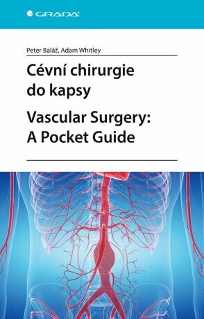 Cévní chirurgie do kapsy. Vascular Surgery: A Pocket Guide - e-kniha