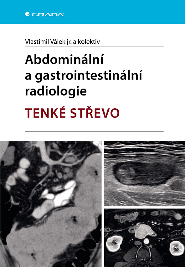 E-kniha: Abdominální a gastrointestinální radiologie od Válek jr. Vlastimil