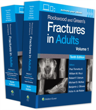 Rockwood and Green's Fractures in Adults: Print + eBook with Multimedia - Benjamin J., MD Ollivere, Victor A., MD PhD MBA PhD de Ridder, Robert F. Ost