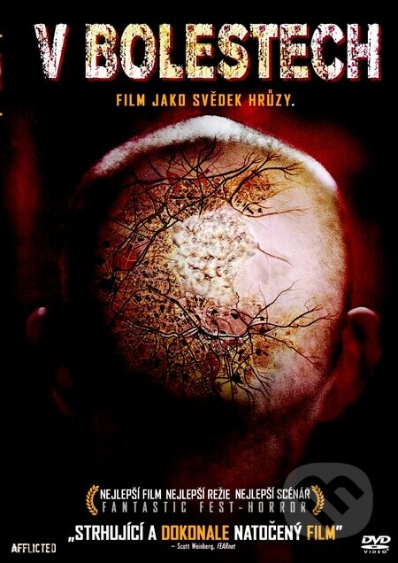 V bolestech DVD