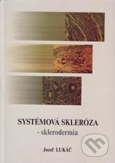 Systémová skleróza - sklerodermia - Jozef Lukáč