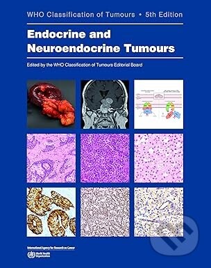 WHO Classification of Endocrine and Neuroendocrine Tumours - IARC