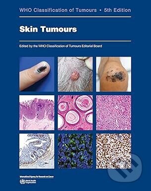 WHO Classification of Skin Tumours - IARC