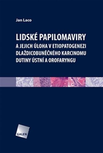 Lidské papilomaviry
					 - Laco Jan