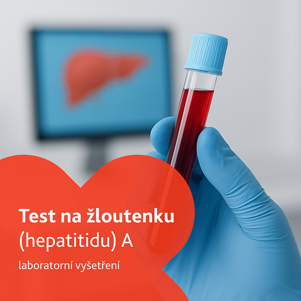 Test na žloutenku (hepatitidu) A laboratorní vyšetření