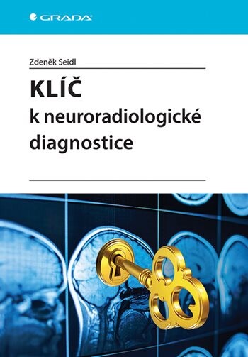 E-kniha: Klíč k neuroradiologické diagnostice od Seidl Zdeněk