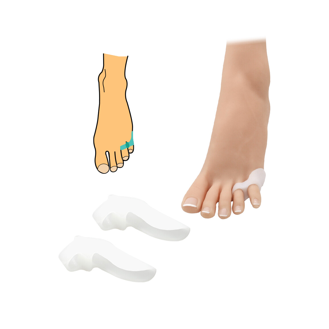 Korektor na malíček s návlekem HealMed 1 pár - bílý