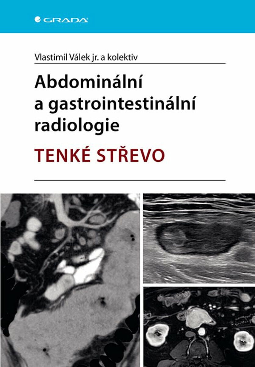 Abdominální a gastrointestinální radiologie - jr. Vlastimil Válek