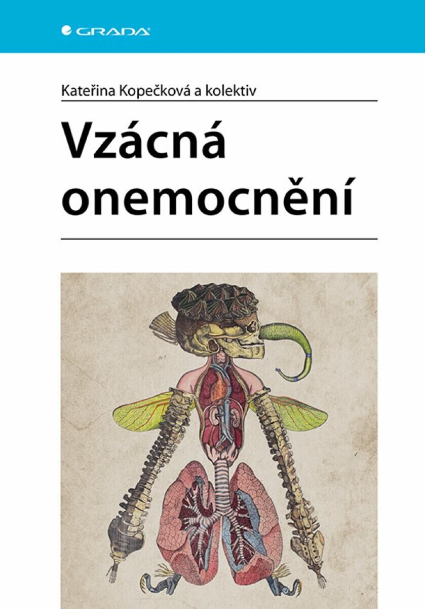 Vzácná onemocnění - Kateřina Kopečková