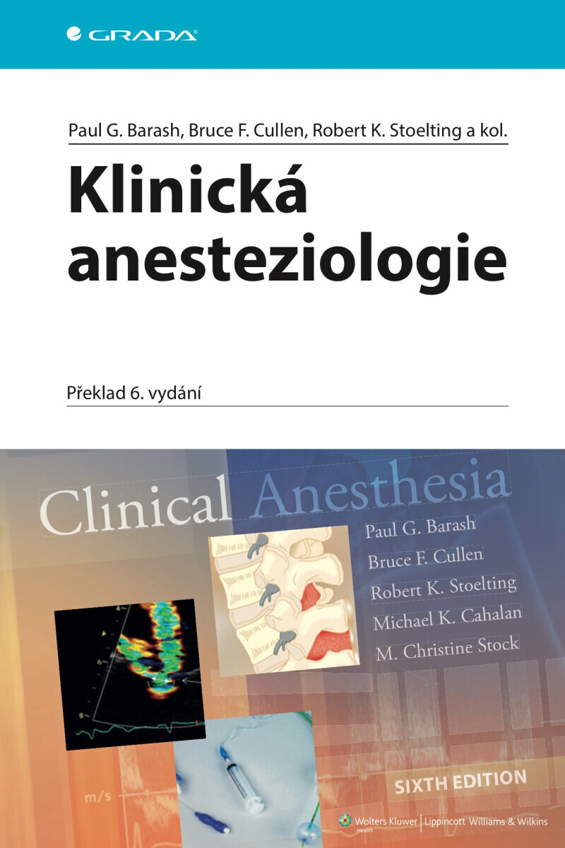 Klinická anesteziologie - Barash Paul G., Bruce F. Cullen, Robert K. Stoelting