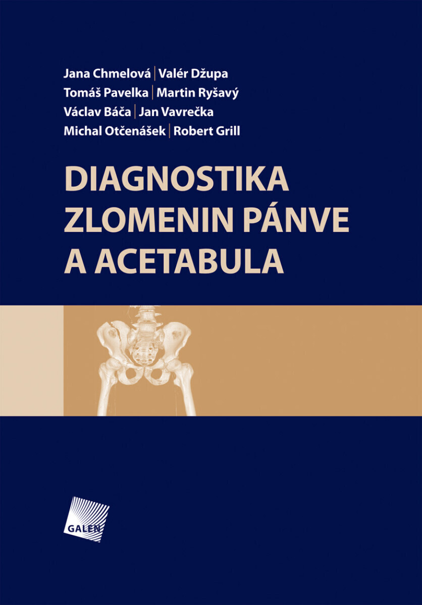 Diagnostika zlomenin pánve a acetabula - Jana Chmelová, Valér Džupa, Tomáš Pavelka, Jan Vavrečka, Václav Báča