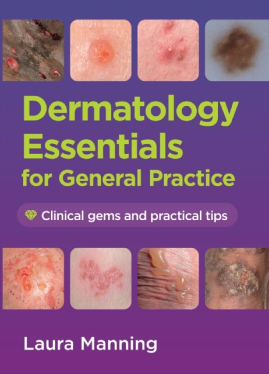 Dermatology Essentials for General Practice - Laura  Manning