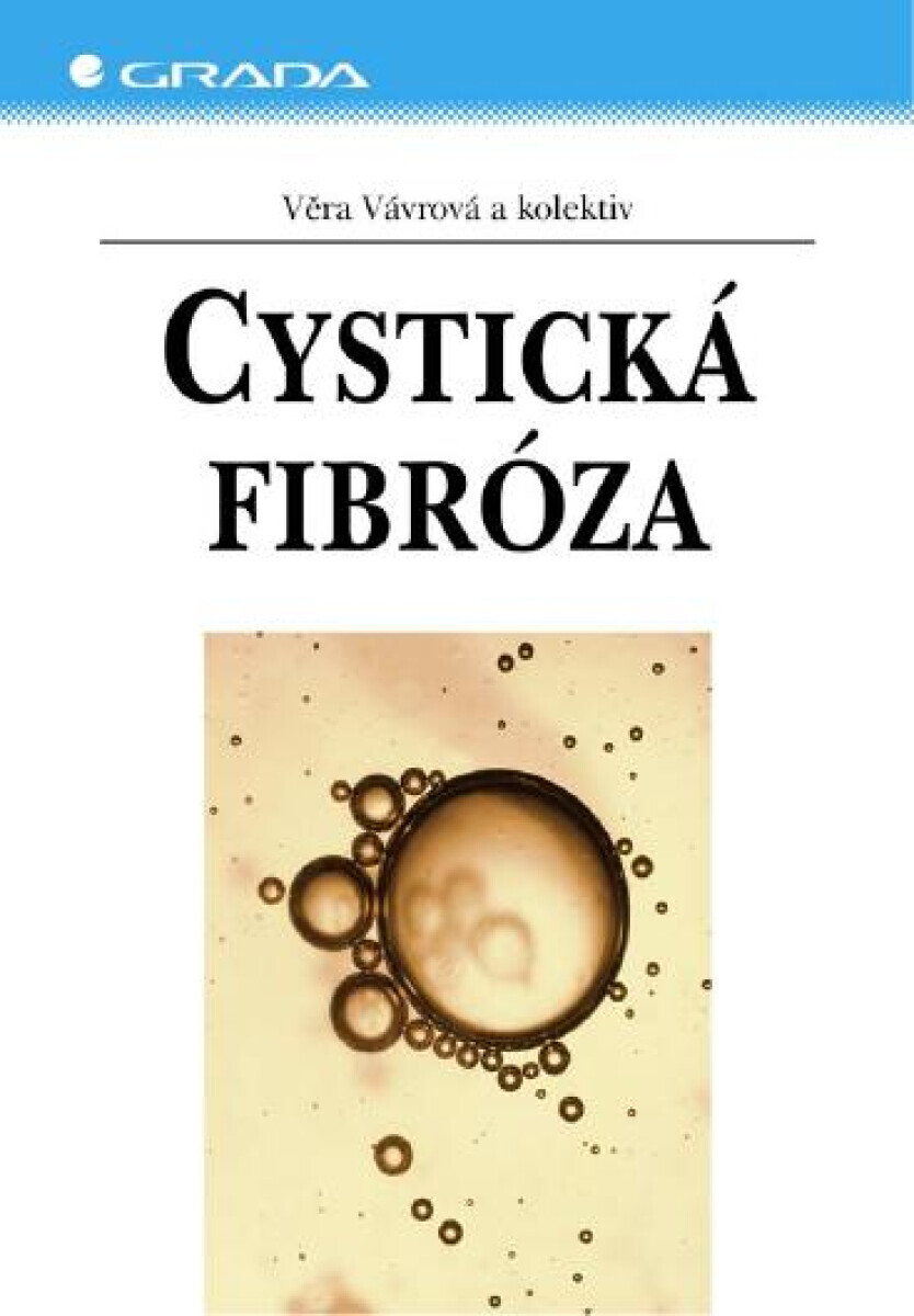 Cystická fibróza - Věra Vávrová