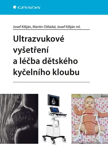 E-kniha: Ultrazvukové vyšetření a léčba dětského kyčelního kloubu od Kiliján Josef
