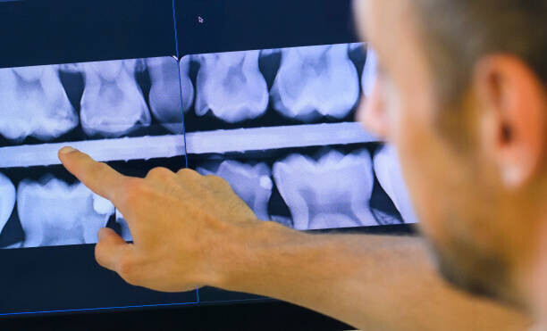 picture alliance Plakát, Obraz - Illustration - Dental care in Lower Saxony, picture alliance, ×  cm
