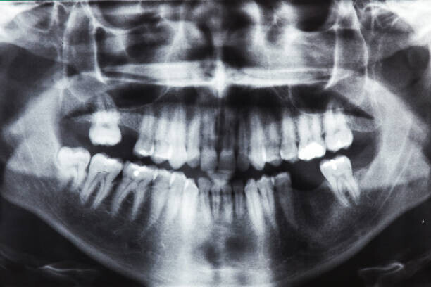 jopstock Plakát, Obraz - Closeup x-ray image of teeth and mouth, jopstock, 40 × 26.7 cm