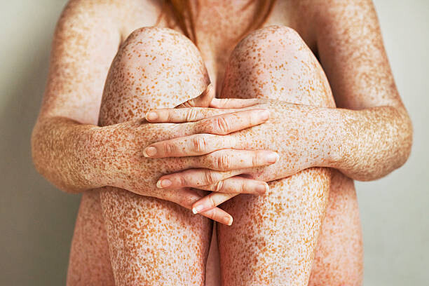 Dimitri Otis Plakát, Obraz - Freckled girls hands, arms and legs, close up, Dimitri Otis, 40 × 26.7 cm