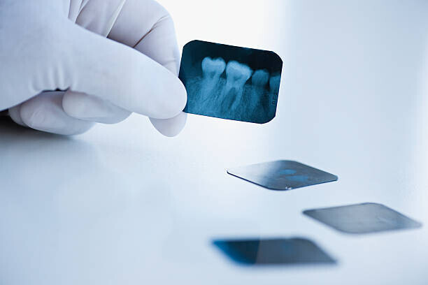 Tetra Images Plakát, Obraz - Dental x-ray, Tetra Images, 40 × 26.7 cm
