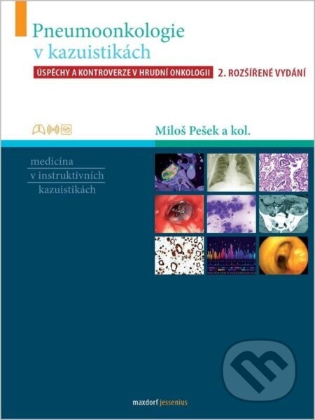 Pneumoonkologie v kazuistikách - Úspěchy a kontroverze v hrudní chirurgii