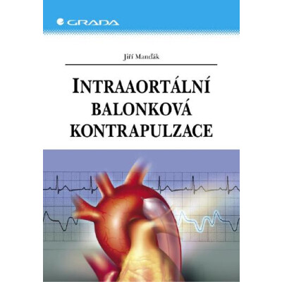 Intraaortální balonková kontrapulzace