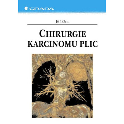 Chirurgie karcinomu plic