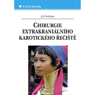 Chirurgie extrakraniálního karotického řečiště