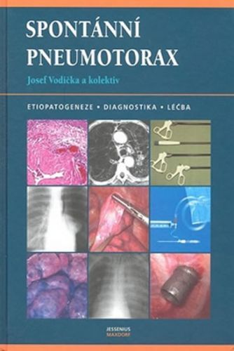 Spontánní pneumotorax
					 - Vodička Josef a kolektiv