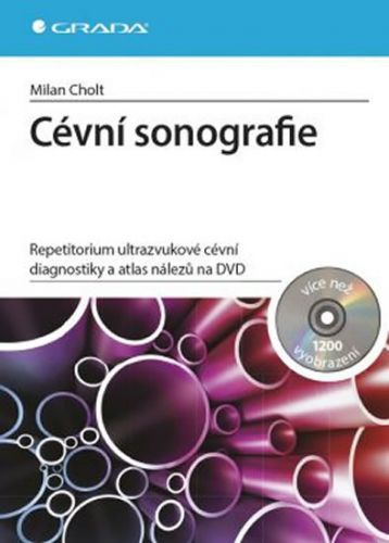 Cévní sonografie - repetitorium ultrazvukové cévní diagnostiky a atlas nálezů na DVD
					 - Cholt Milan