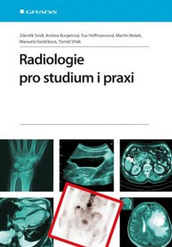 E-kniha: Radiologie pro studium i praxi od Seidl Zdeněk