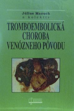 Tromboembolická choroba venózneho pôvodu - Kolektív autorov