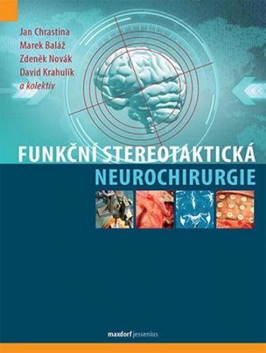 Chrastina Jan, Baláž Marek, Novák Zdeněk: Funkční Stereotaktická Neurochirurgie